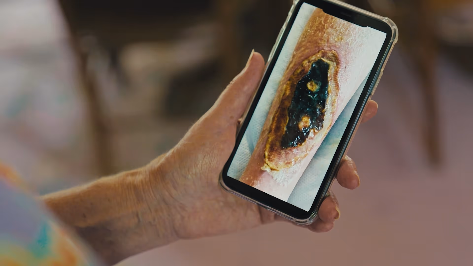 Innovative Treatments